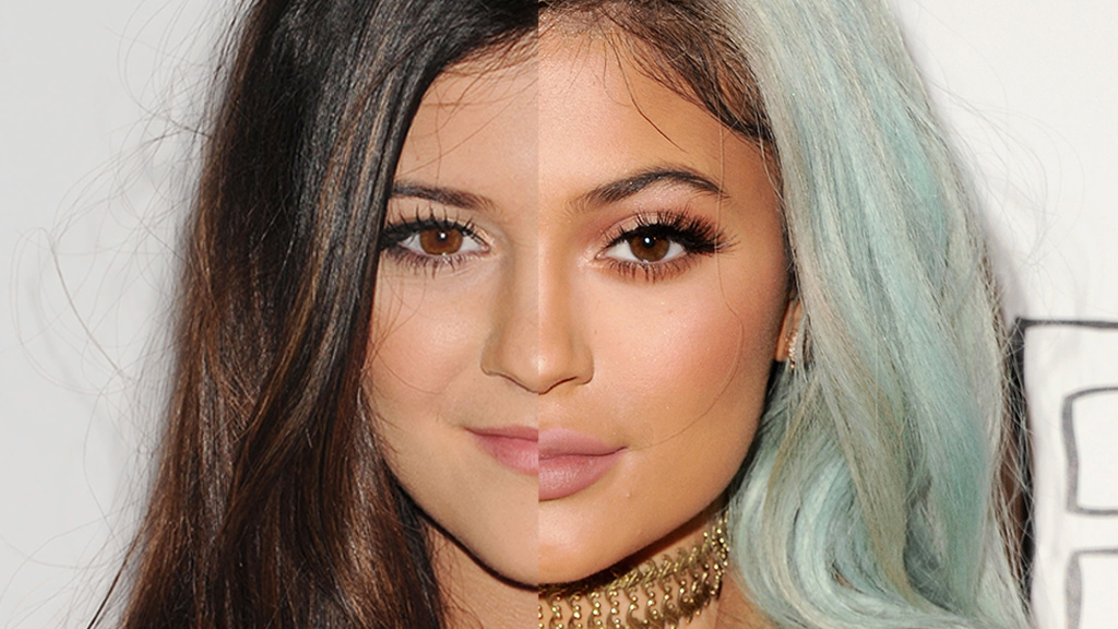 Kylie Jenner's Face Has Changed A LOT, Here's Proof