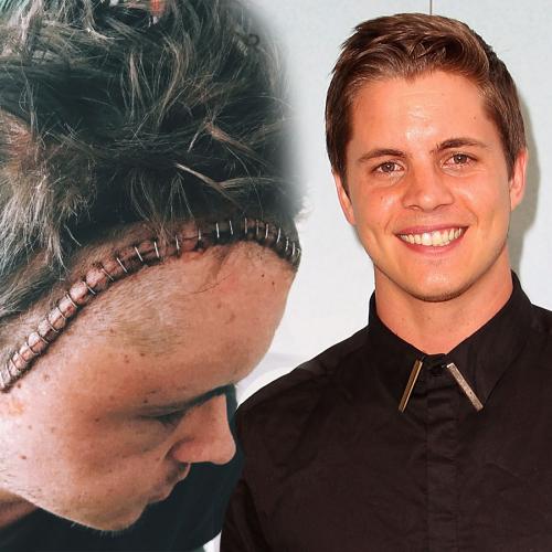 Johnny Ruffo Is Officially Cancer-Free