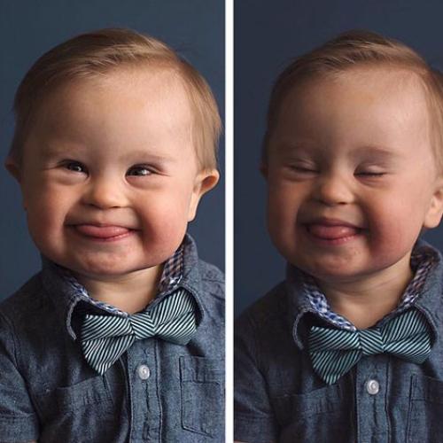 Mum Supports Son With Downs After Denied Modeling Work