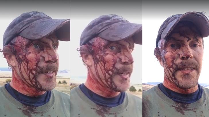 Bear Attack Survivor Recounts Ordeal On Facebook