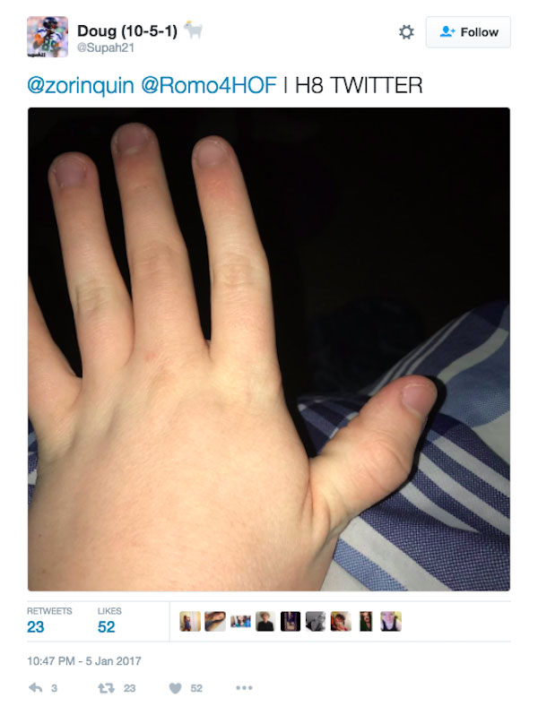 Idiots Are Breaking Their Thumb Ligaments And Posting Online