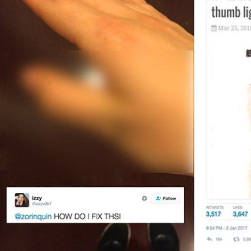 Idiots Are Breaking Their Thumb Ligaments And Posting Online