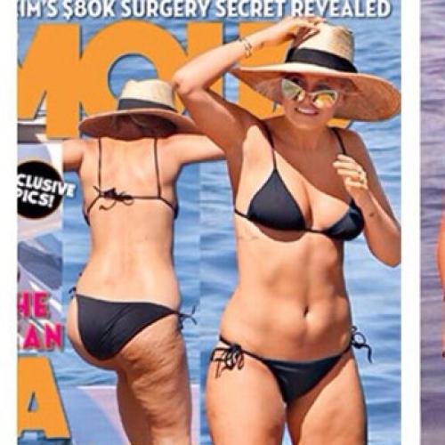 Lara Bingle Slams Mag For Photoshopping In Cellulite