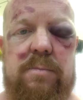 Aussie Paramedic Bashed By Teenagers During Charity Bike Ride