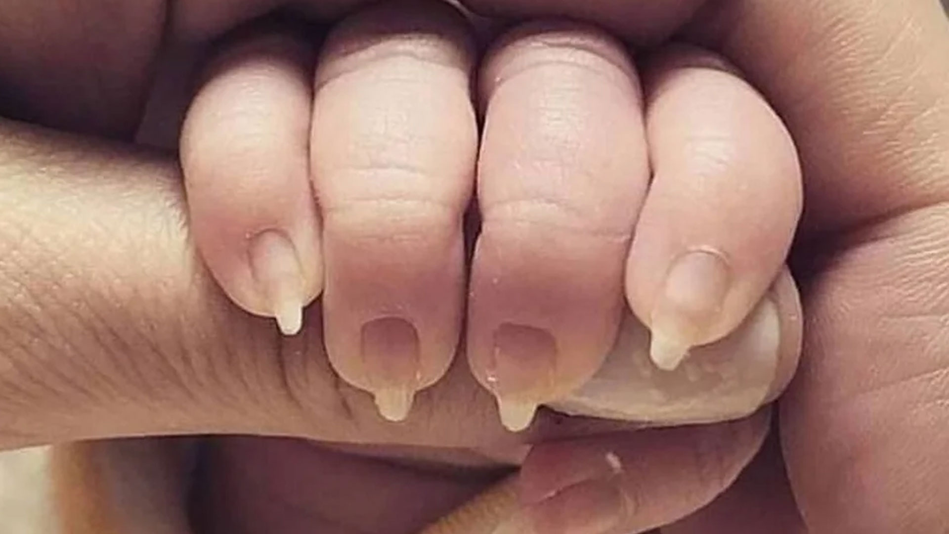 reddit baby foot